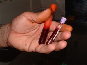 blood test after a DUI arrest in Virginia